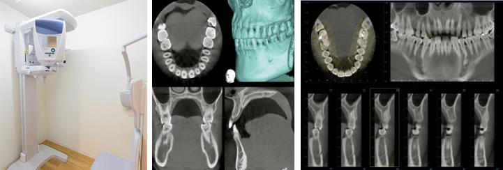歯科用CT装置