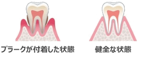 診療案内|曽根駅前歯科クリニック