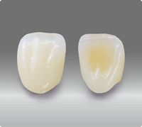 診療案内|曽根駅前歯科クリニック