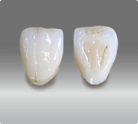 診療案内|曽根駅前歯科クリニック